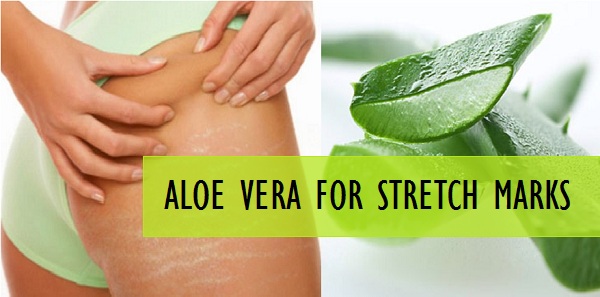 Effective Aloe Vera Recipes For Stretch Marks Removal