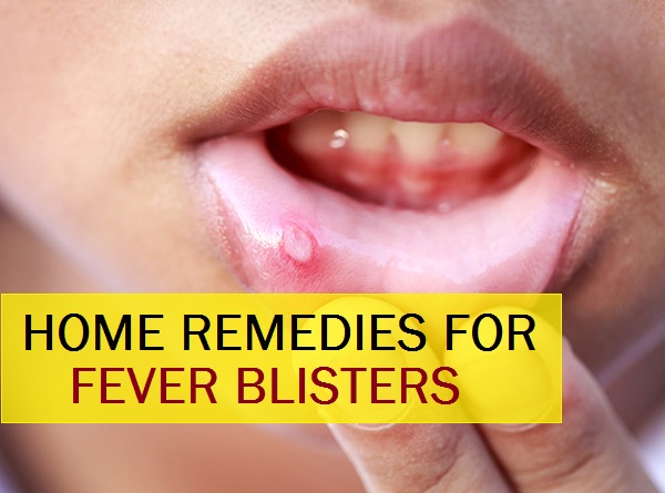 Best Indian Home Remedies To Treat The Fever Blisters 6450