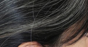 premature greying of hair remedies