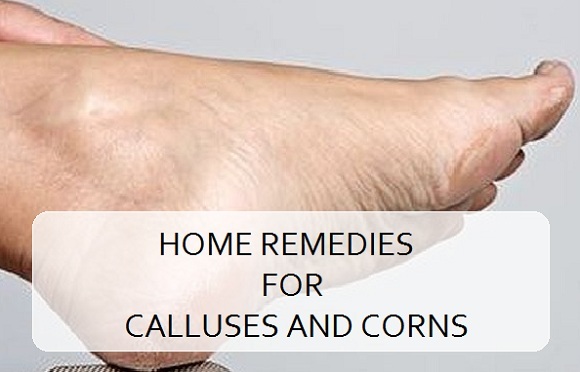 Home Remedies for Calluses and Corns on feet, hands