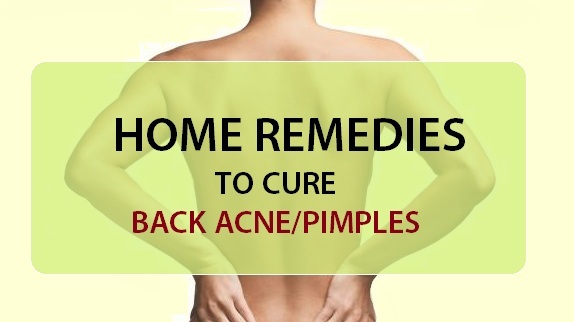 home remedies for back acne pimples