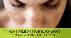 Home remedies for black spots, dark spots, age spots, pimple marks