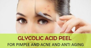 homemade glycolic acid peel for pimple acne aging