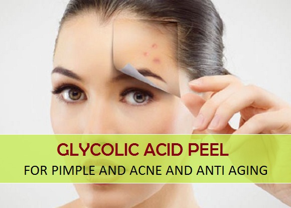 Homemade Glycolic Acid Peel for pimple