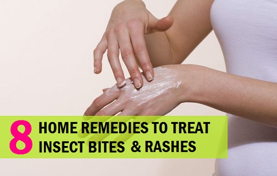 Home Remedies for Insect Bite and Rashes