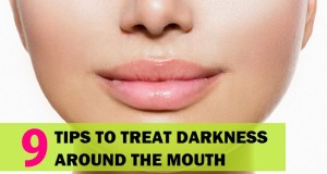 Home Remedies for Darkness around Mouth and Lips