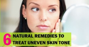 Natural Remedies to Treat Uneven Skin tone