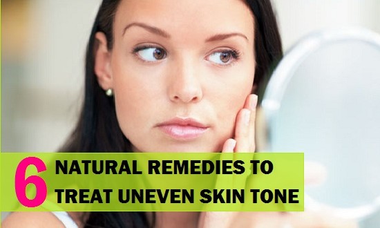 6 Best Natural Remedies To Treat Uneven Skin Tone On Face