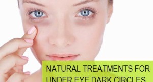 Natural Treatments for Under Eye Dark Circles
