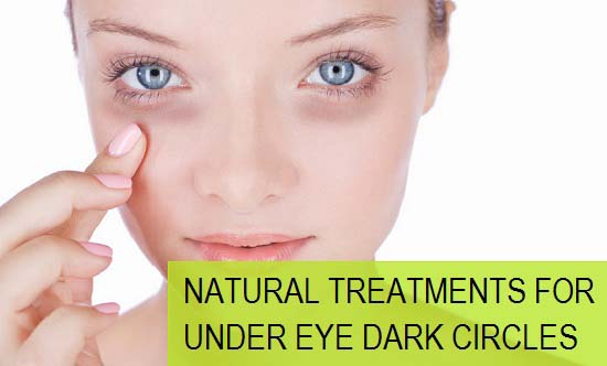 Natural Treatments for Under Eye Dark Circles 