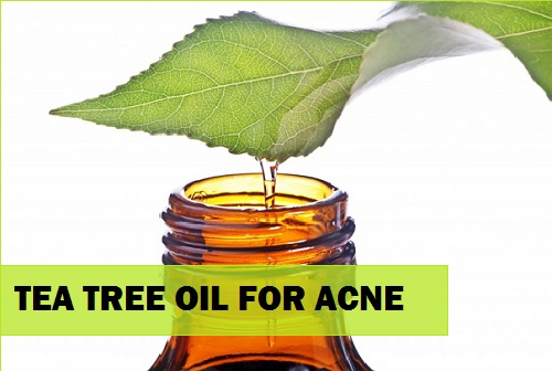 Natural Herbal Remedies for Acne and Pimples with tea tee oil