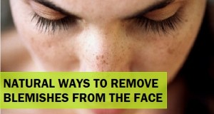 Efficient Ways to Remove Blemishes from Face