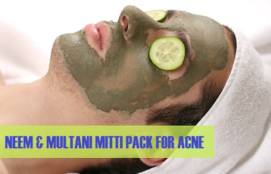 neem and Multani Mitti Packs for acne, pimples, oily skin and fairness