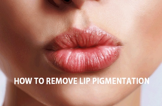 10 Beauty tips to Remove Lip Pigmentation at home fast