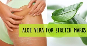 Aloe Vera Recipe for Stretch Marks Removal