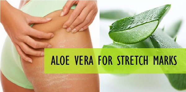 4 Effective Aloe Vera Recipes For Stretch Marks Removal