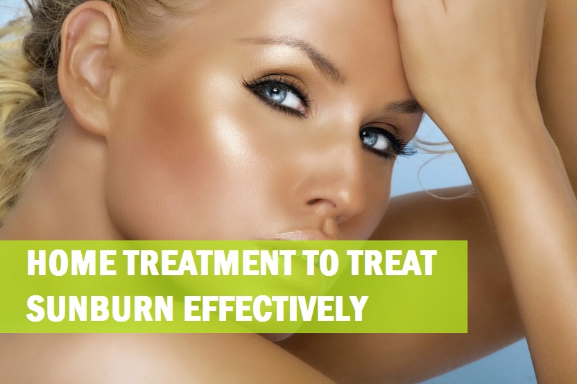 Home treatment to treat sunburn effectively at home