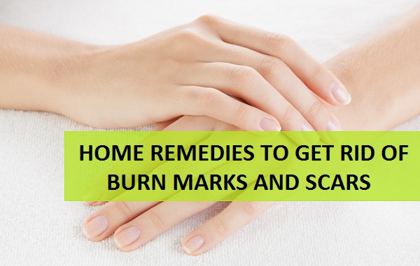 How to get rid of the burn marks and scars at home