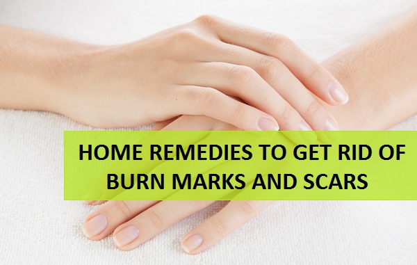 how-to-get-rid-of-the-burn-marks-and-scars-at-home