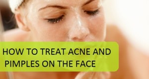 How to treat Acne and Pimples on the face