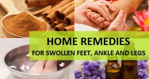 Home Remedies for Swollen Feet, Ankle and Legs