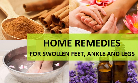 Home Remedies for Swollen Feet, Ankle and Legs