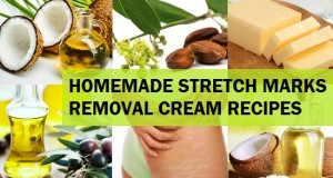 Homemade Natural Stretch Marks Removal Cream Recipes