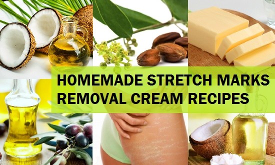Herbal Cream Recipes For Stretch Marks