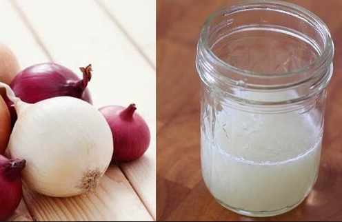 How to use onion Juice for Herbal Hair Loss Treatment