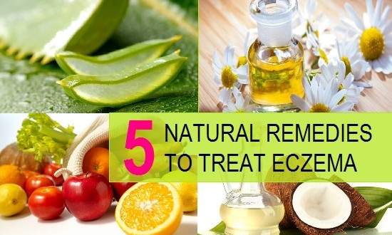 5 Home Remedies to Treat Eczema at Home