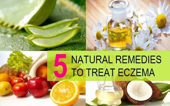 Natural ways to treat Eczema