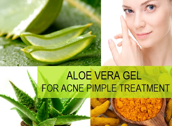 Aloe Vera for Pimples, Acne, Scars, Marks on face