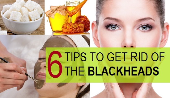 how to get rid of blackheads faster 