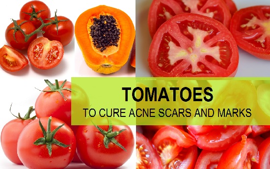 tomato to cure acne scars and marks featured