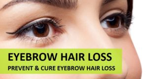 How to prevnet and cure eyebrow hair loss