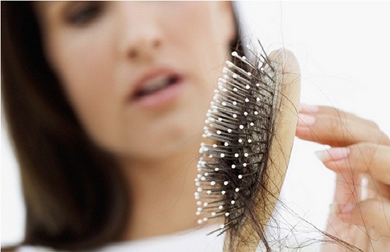 Best Remedies for Female Hair Loss and How to Control Hair fall