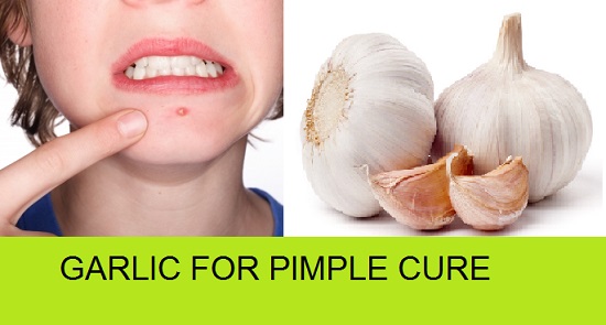 How to use Garlic for Pimples and Acne cure TREATMENT