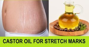 Castor oil to Treat Stretch Marks and Blemishes on the body