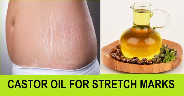 Castor oil for Stretch Marks and Blemishes on the body