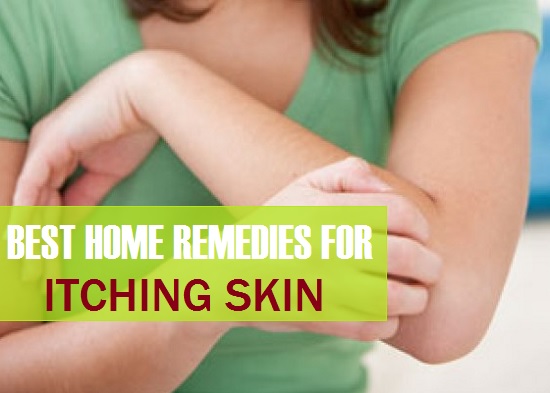home remedy itch relief