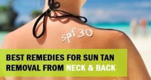 10 Best Remedies to Remove Suntan from Neck and Back