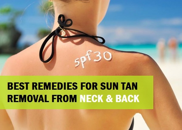 10 Best Remedies to Remove Suntan from Neck and Back