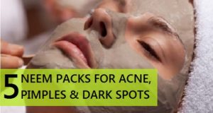 Neem face packs for acne pimples and dark spots