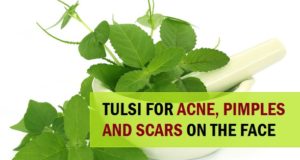 how to use Tulsi to Treat Pimples and Acne 4