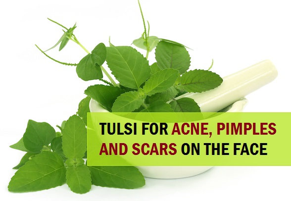 how to use Tulsi to Treat Pimples and Acne 4