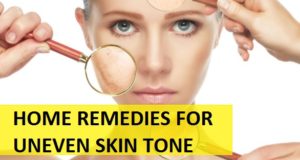 home remedies for uneven skin tone