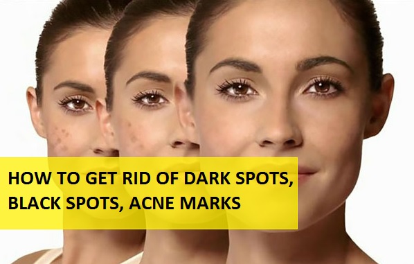 home remedies for dark spots and black spots on face