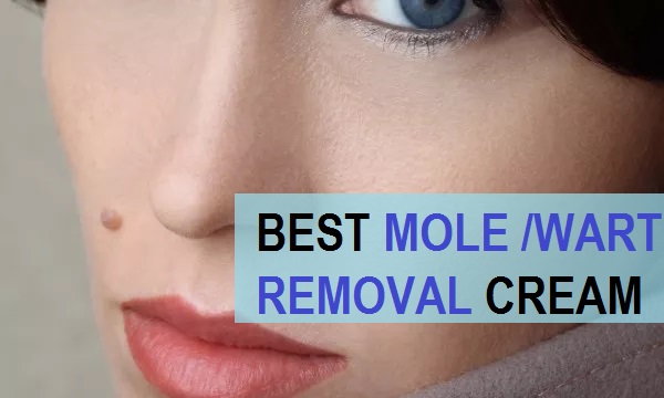 best mole removal cream in india