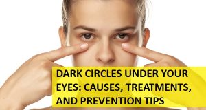 Dark Circles Under Your Eyes: Causes, Treatments, and Prevention Tips