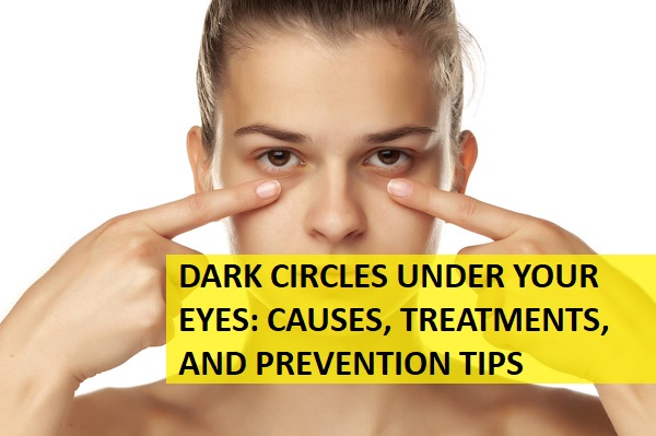 Dark Circles Under Your Eyes: Causes, Treatments, and Prevention Tips